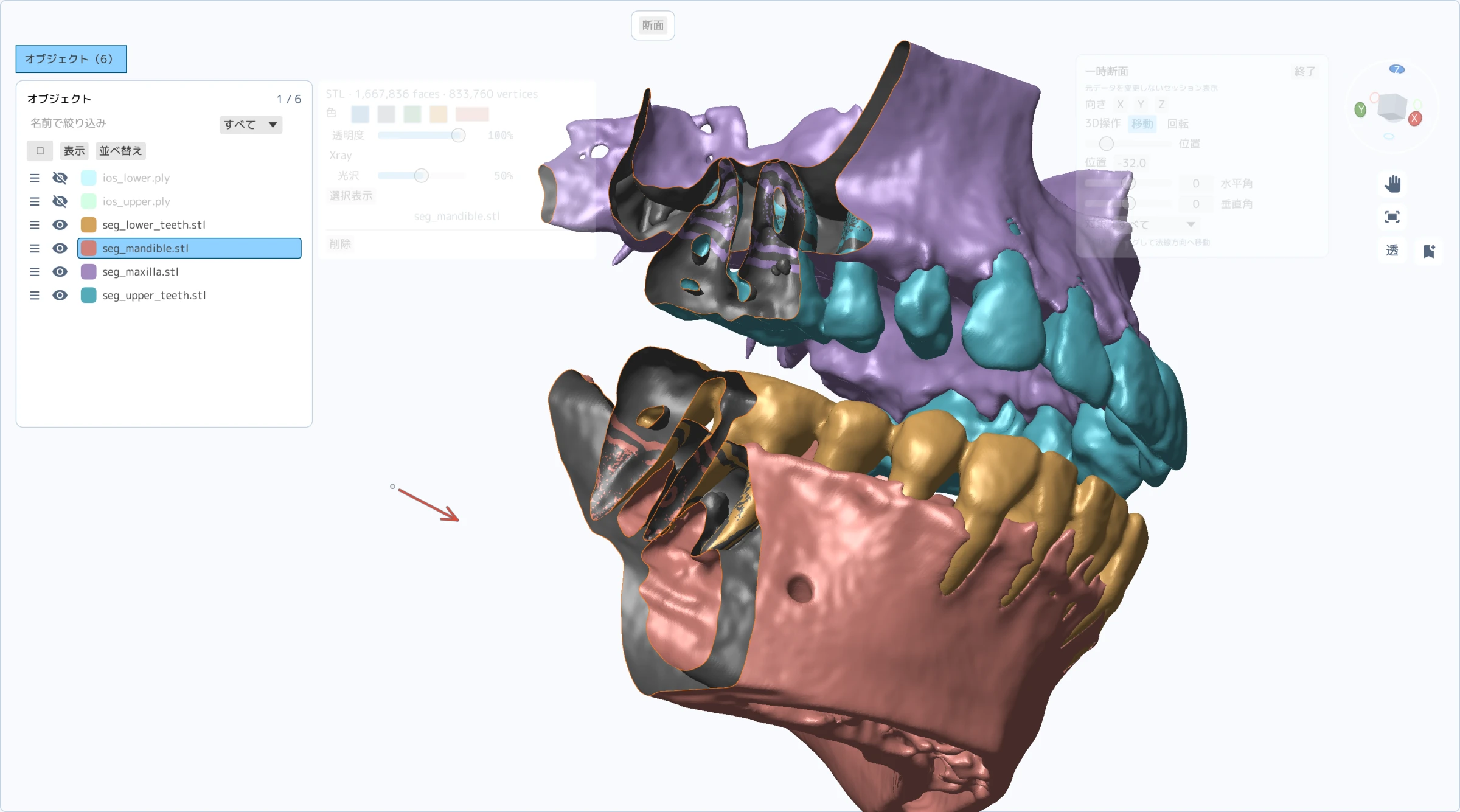 複数の顎骨と歯の3Dデータを断面表示し、内部の形を確認しているManaitaの実画面
